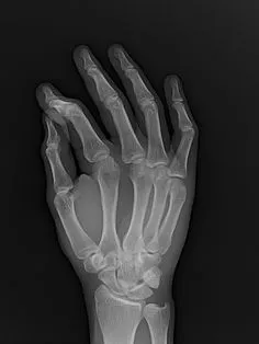 Arm Anatomy, Anatomy Art, Human Anatomy, Radiology Imaging, Radiology Tech, Xray Art, Hand Bone, Human Bones, Radiography